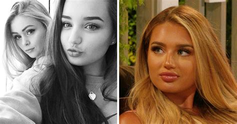 kenzie love|mackenzie love island plastic surgery.